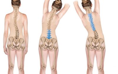 What is Schroth Therapy for Scoliosis?