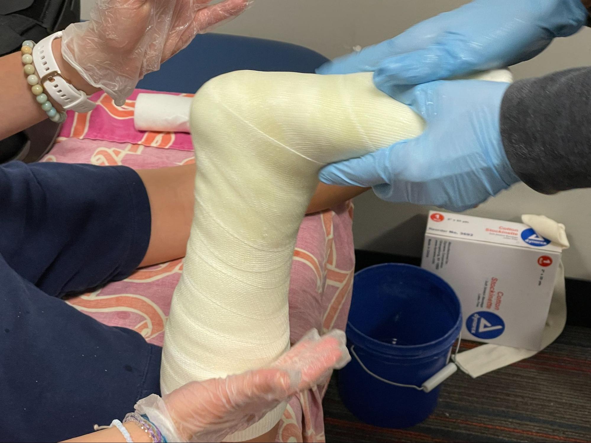 picture of a serial casting being removed during a pediatric physical therapy session at Westside in Illinois
