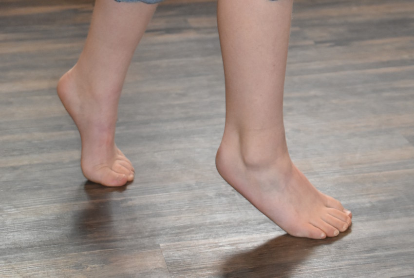 picture of a child toe walking