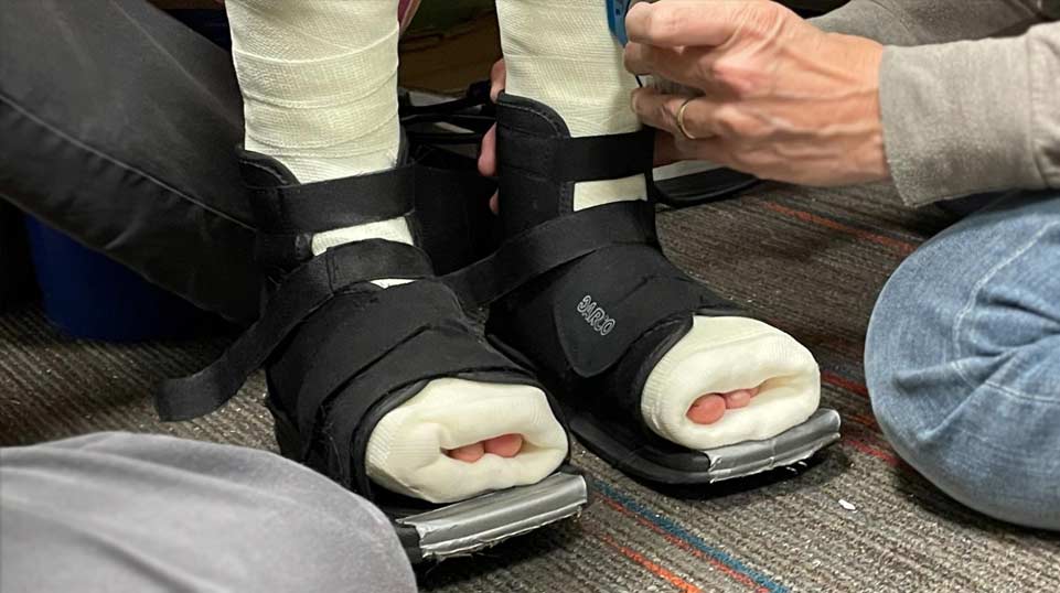 serial cast for child toe walking