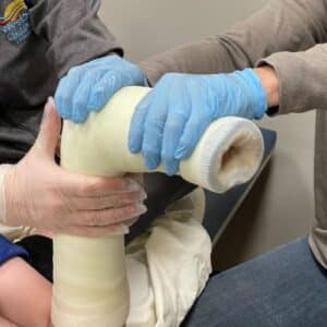 5 Reasons to Start Serial Casting early?